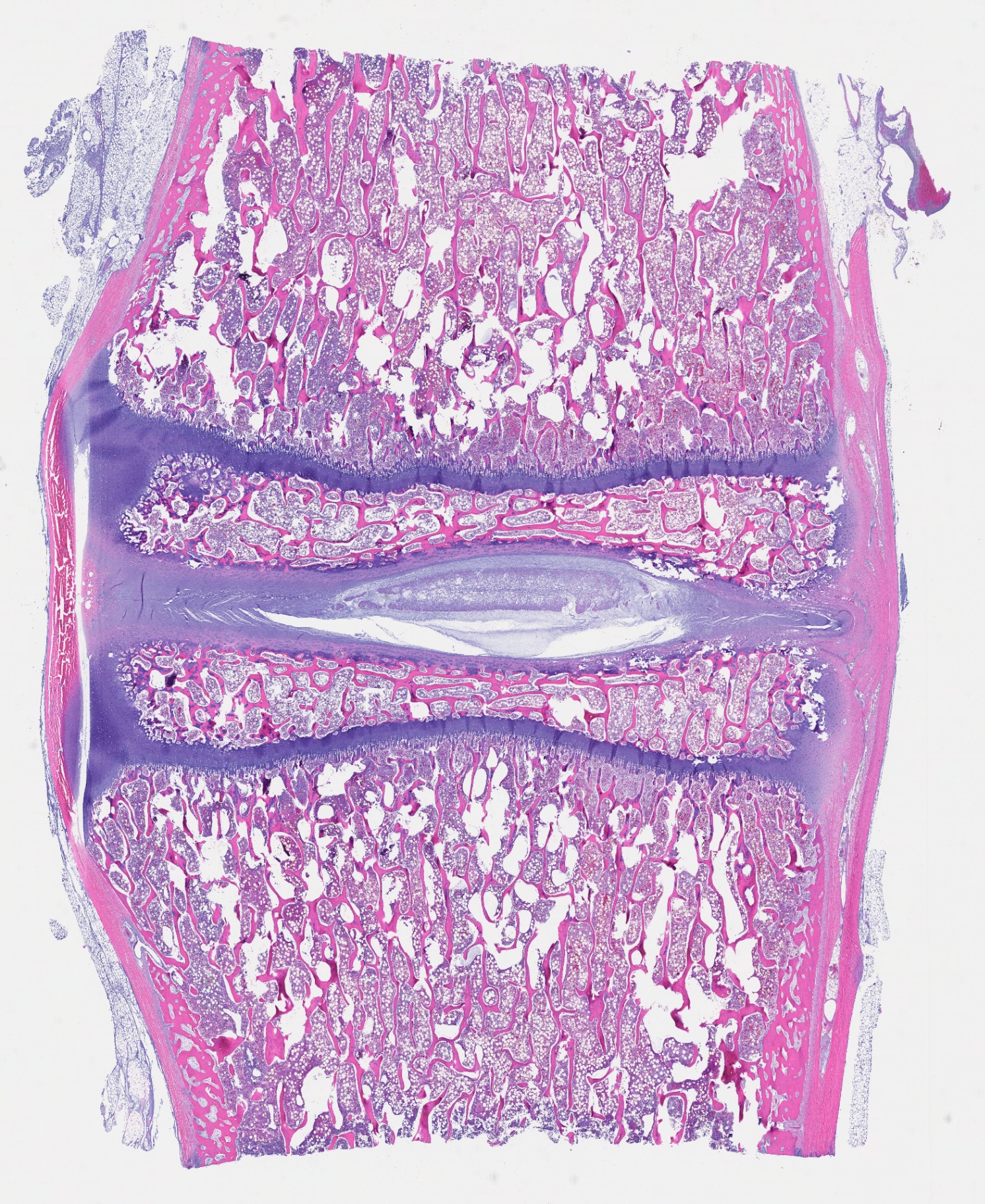 Histological cross-section of a spinal motion segment from translational research