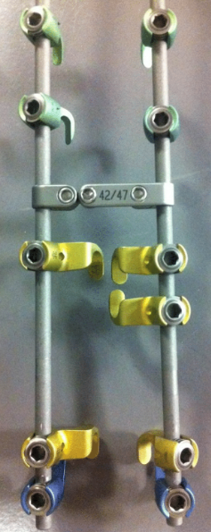 Posterior fixation construct assembled on dual rods with connector plate