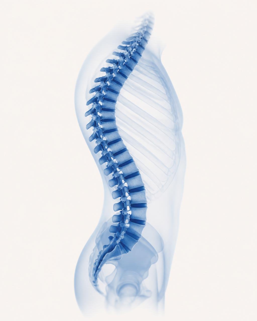 Adult Spinal Deformity